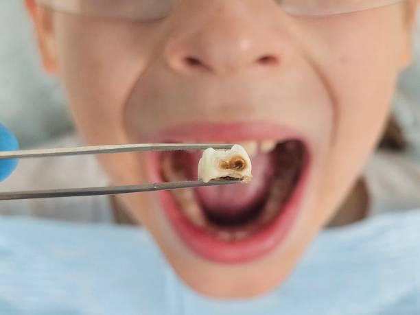 Best Emergency Dental Care for Trauma or Injury in Federal Y, WA